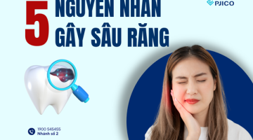Nguyen-nhan-gay-sau-răng