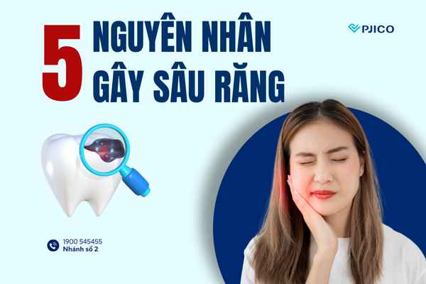 5-nguyen-nhan-gay-sau-rang